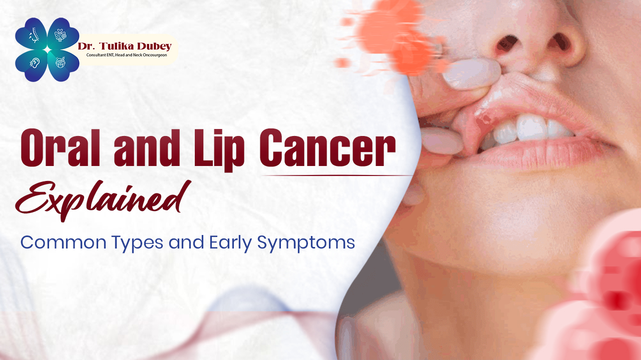 Oral and Lip Cancer