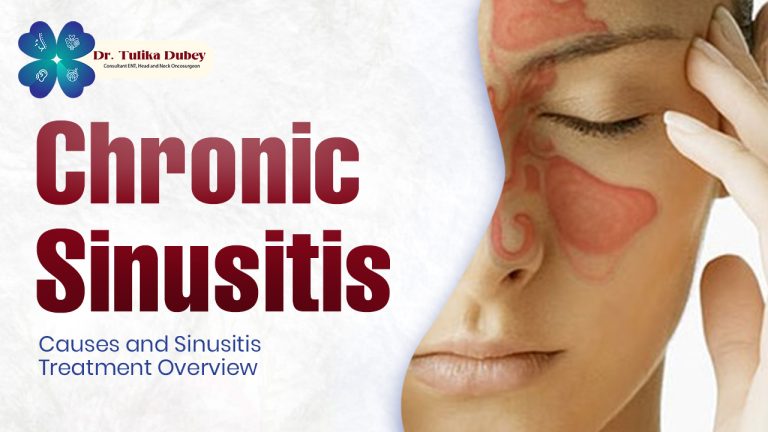 Chronic Sinusitis: Causes and Sinusitis Treatment Overview